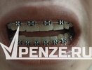 Посещения бывшей стоматологии на ул. Попова хотят продать